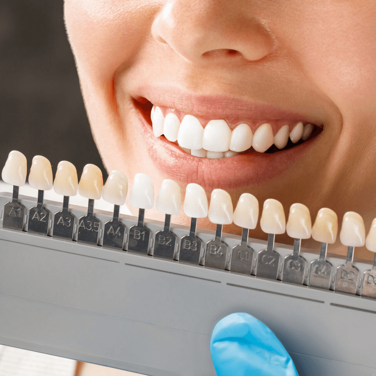 Teeth Whitening